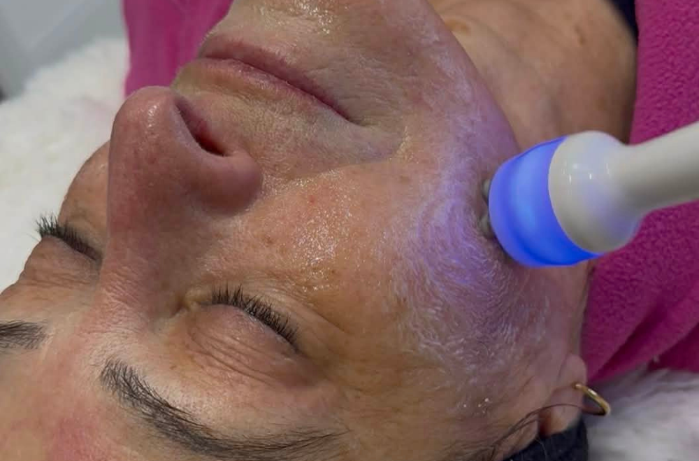 skin tightening